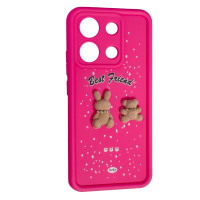 Чехол Накладка Best Fiend Xiaomi Redmi Note 13 4G Розовая Чехол Накладка Best Fiend Xiaomi Redmi Note 13 4G Розовая