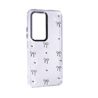 Чохол Накладка Glue Case Hit Xiaomi Redmi 15  EU (171mm) Бантики