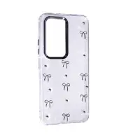 Чохол Накладка Glue Case Hit Xiaomi Redmi 15  EU (171mm) Бантики